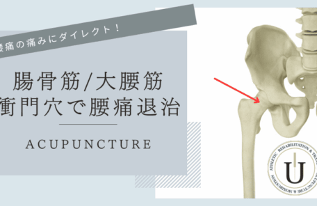 腰痛に関連が深い腸腰筋と衝門穴